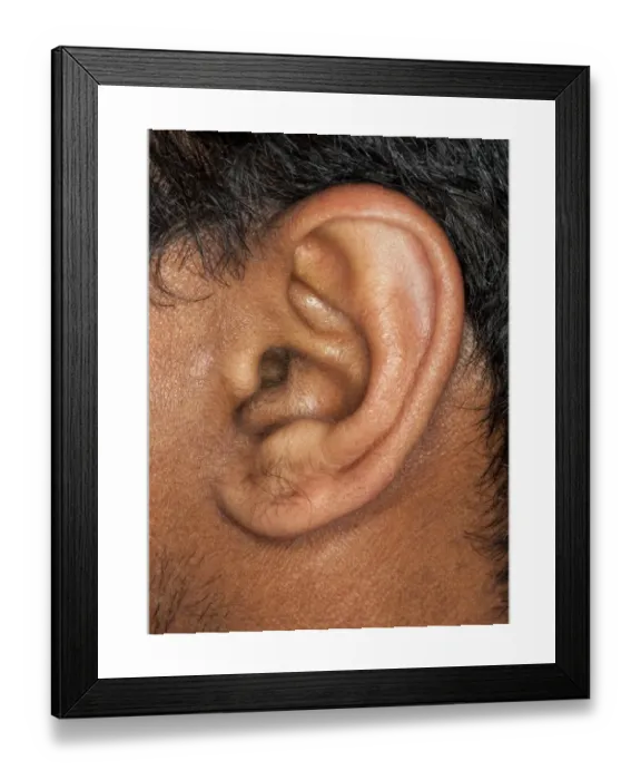 Framed Print : Human Ear Close-up Print Framed Print : Human Ear Close-up Print
