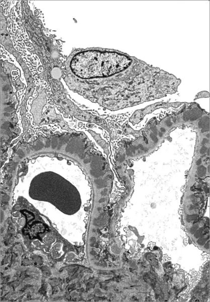 Kidney glomerulus, TEM C016  /  5831