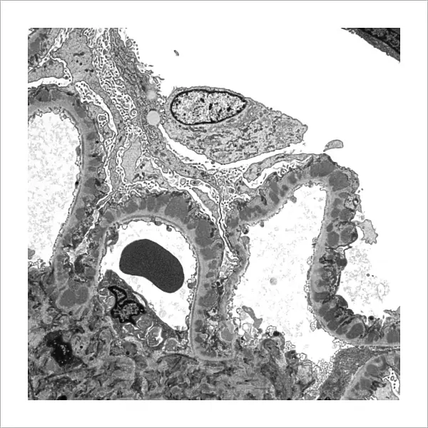 Kidney glomerulus, TEM C016  /  5831