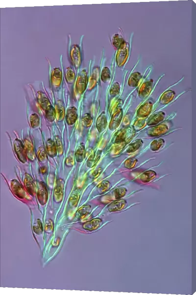 Golden algae, light micrograph