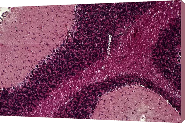 Cerebrum, light micrograph C014  /  0636