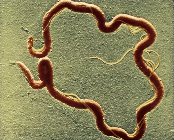 Syphilis bacterium, TEM C016  /  9461