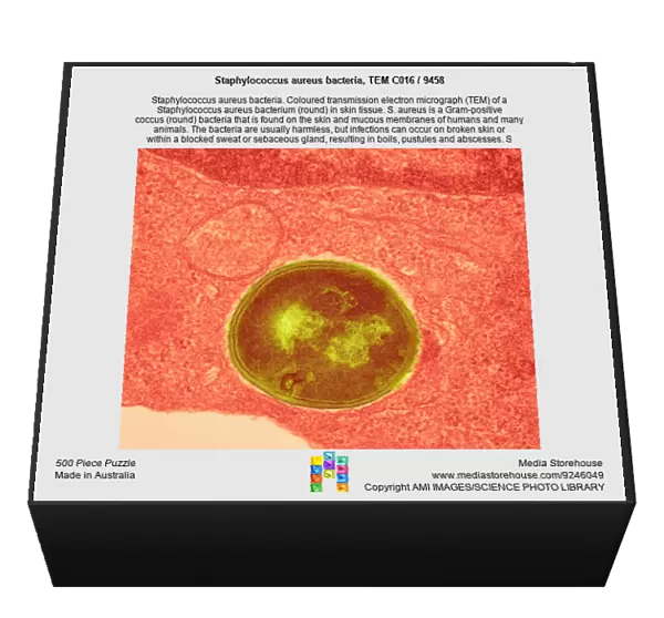 Staphylococcus aureus bacteria, TEM C016  /  9458