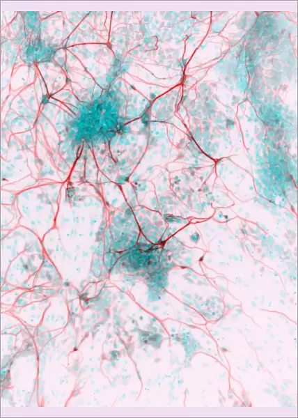 Stem cell-derived neurons, micrograph