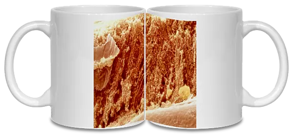 Coloured SEM of section through well-cooked meat