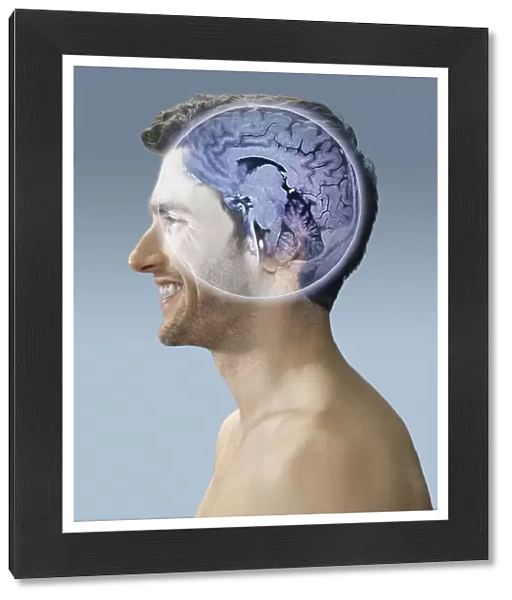 Brain scan, conceptual image C017  /  7398