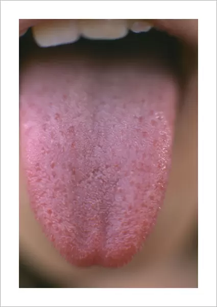 20016535. HEALTH Taste Close view of childs tongue showing taste buds