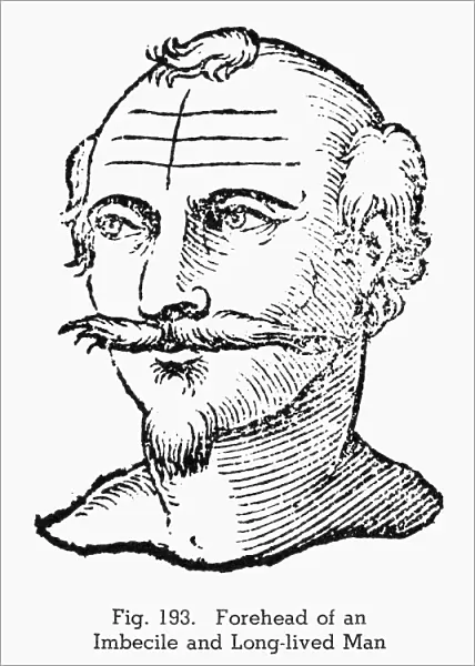PHYSIOGNOMY, 1637. Forehead of an imbecile and long-lived man