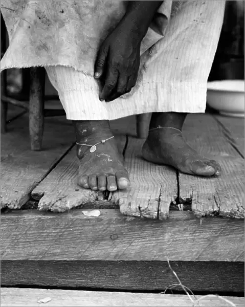 SHARECROPPER, 1937. A fifty-seven year old African American sharecroppers feet