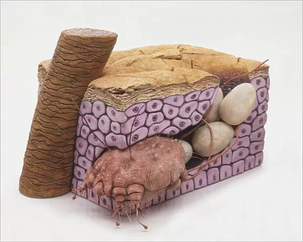 Cross-section model of Bedbug (Cimicidae) burrowed in skin, laying eggs