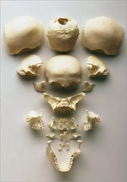 Human skull separated into its individual bones, including front, cheek, concha, vomer, nasal and jaw bones
