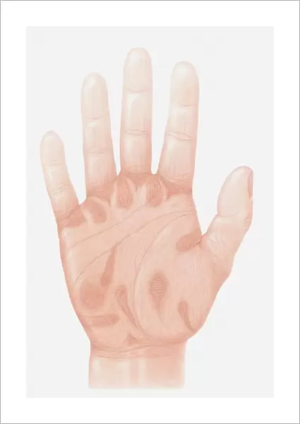 Illustration of accu-pressure points on palm of human hand