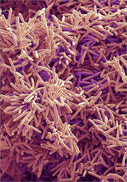 Plaque-forming bacteria, SEM