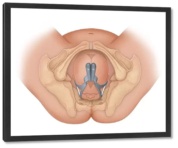 Doctors view of a baby in occiptital anterior position being delivered by proper use of