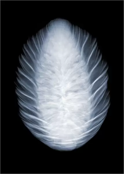 Norway spruce (Picea abies) cone, X-ray