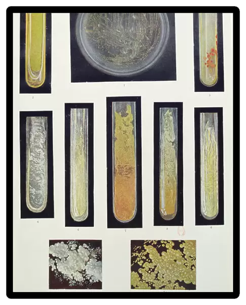 Syphilus Bacillus, from a book by Max von Niessen, Leipzig, 1908 (colour litho)