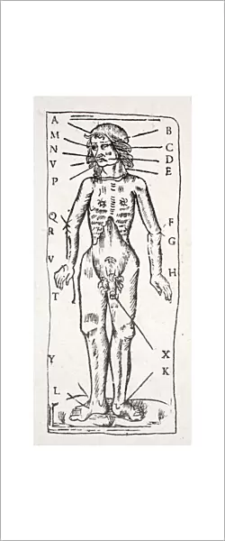 A body which has been under the scalpel, with veins labelled (litho)