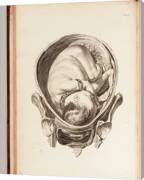 Engraving of a child in the womb from A Set of Anatomical Tables, with Explanations