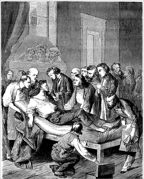 First surgical operation with sulfuric ether anesthesia at Boston Hospital by William Morton, 19th century (engraving)