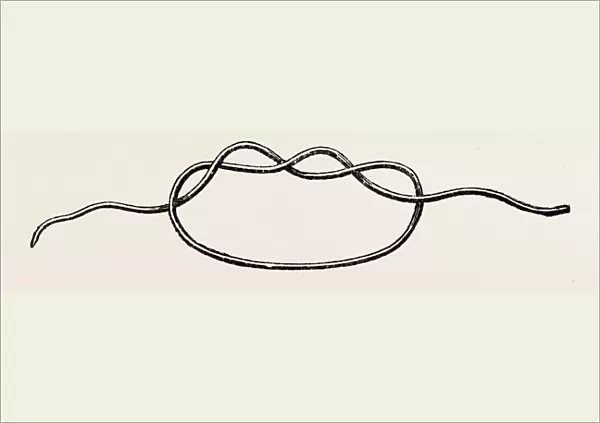 first stage of the surgeons knot, medical equipment, surgical instrument, history