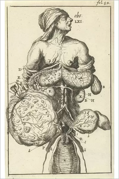 Anatomical image II Print upper right fol 52