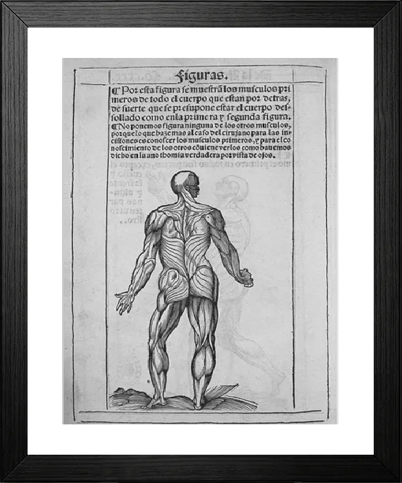 Framed Print : Print of Human Anatomy, 1551 Engraving
