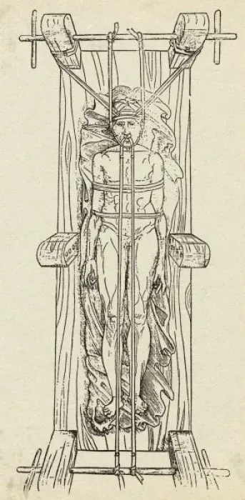 Framed Print : C16 Man in Surgical Vice Print