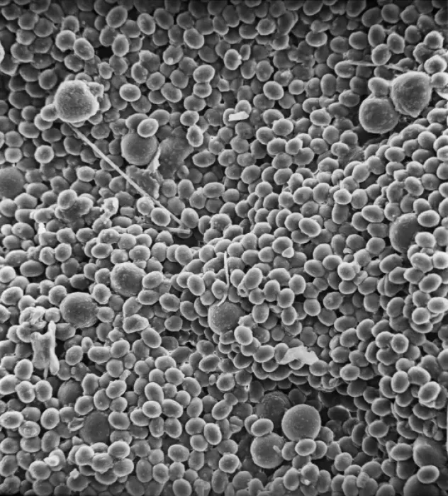 Framed Print : SEM Print of Sticky Pollen on a Bee's Body Framed Print : SEM Print of Sticky Pollen on a Bee's Body