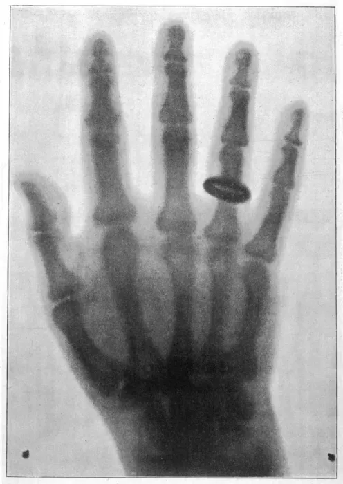 Framed Print : Roentgen X-Ray System Print Framed Print : Roentgen X-Ray System Print