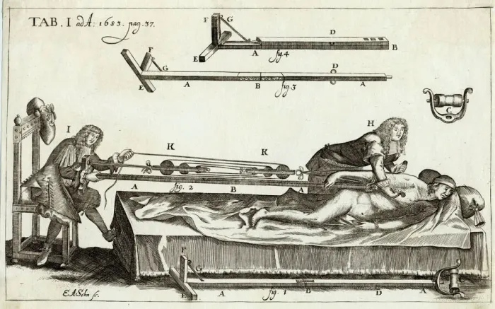 Framed Print : Setting a Bone Print, 1682 Framed Print : Setting a Bone Print, 1682