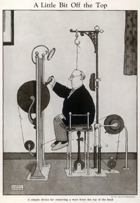 Framed Print : A Complicated Wart Removal Device Print