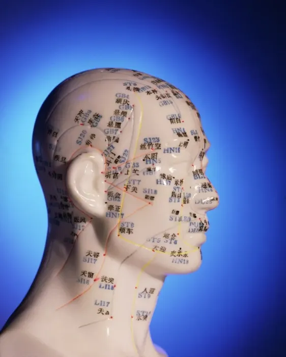 Framed Print : Acupuncture Chart Print on Cast of Head and Neck Framed Print : Acupuncture Chart Print on Cast of Head and Neck