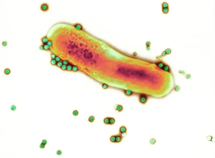 Framed Print : Adenovirus particles and bacterium Print, TEM image Framed Print : Adenovirus particles and bacterium Print, TEM image