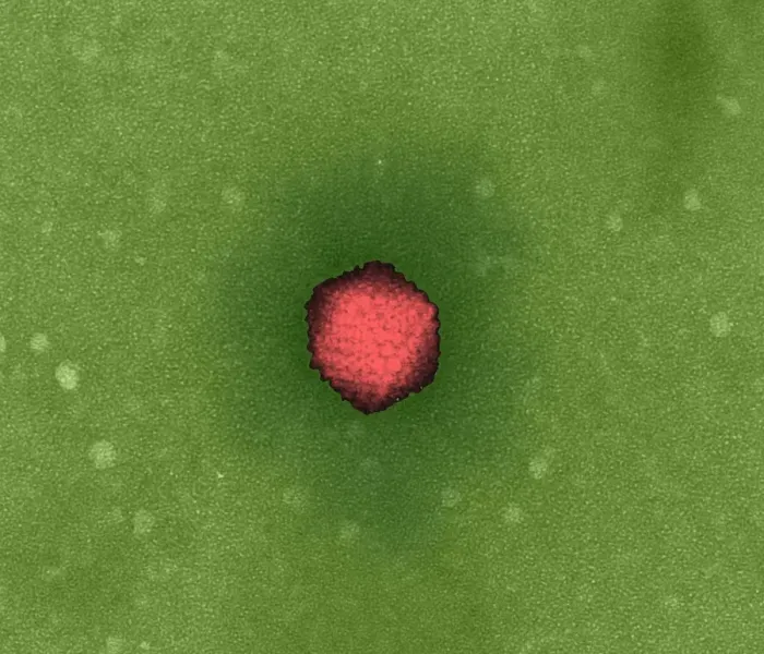 Framed Print : Adenovirus Print, TEM Image Framed Print : Adenovirus Print, TEM Image