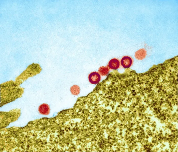 Framed Print : AIDS virus particles budding from a cell Print, TEM image Framed Print : AIDS virus particles budding from a cell Print, TEM image