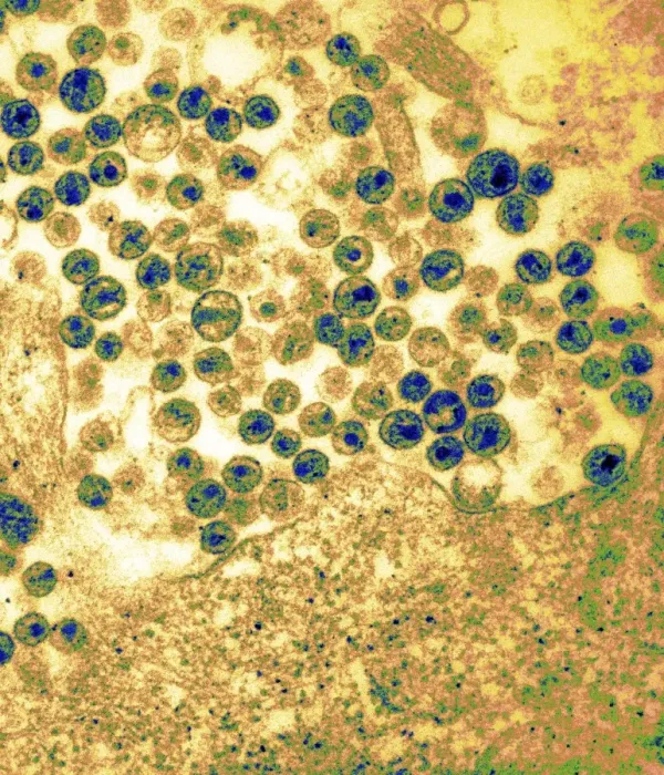 Framed Print : AIDS virus particles budding from a cell, Print Framed Print : AIDS virus particles budding from a cell, Print