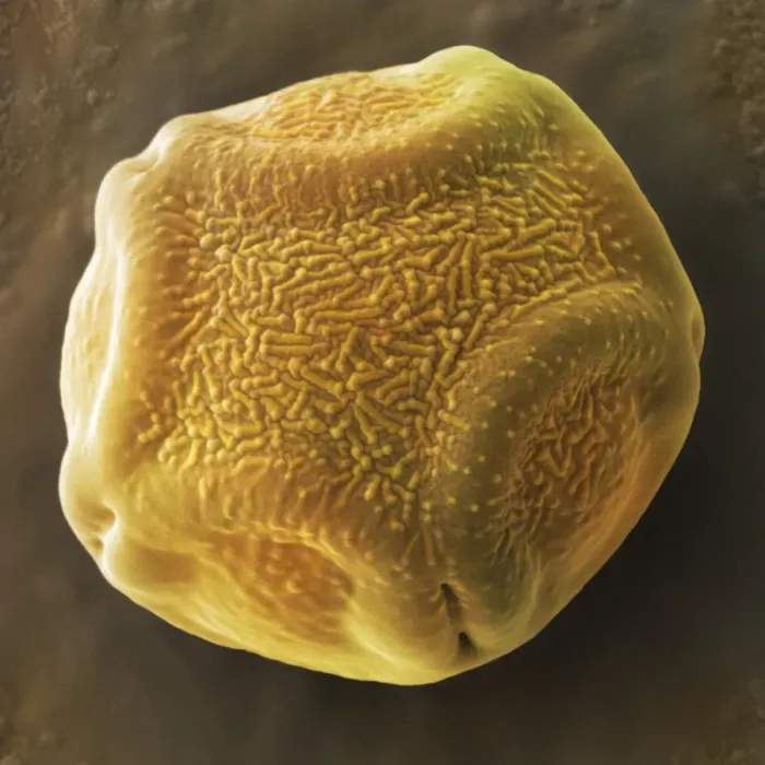 Framed Print : Print of Alder tree pollen grain, SEM Framed Print : Print of Alder tree pollen grain, SEM