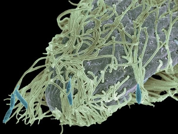 Alga-covered protozoan, SEM