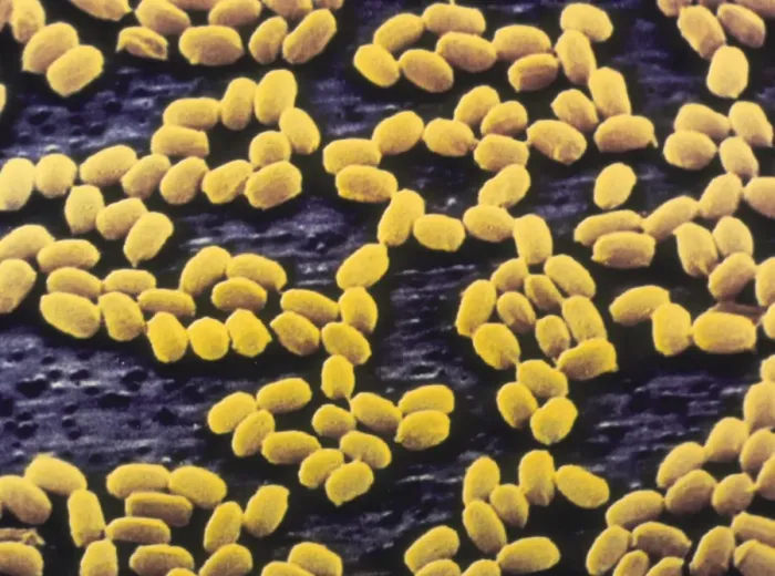 Framed Print : False-colour scanning electron micrograph of Bacillus anthracis spores Framed Print : False-colour scanning electron micrograph of Bacillus anthracis spores