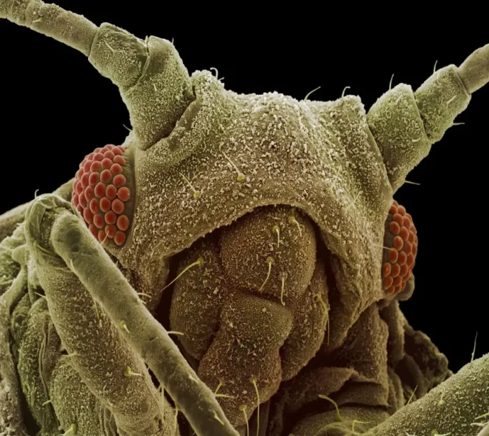 Framed Print : Aphid Head Print, SEM Image Framed Print : Aphid Head Print, SEM Image