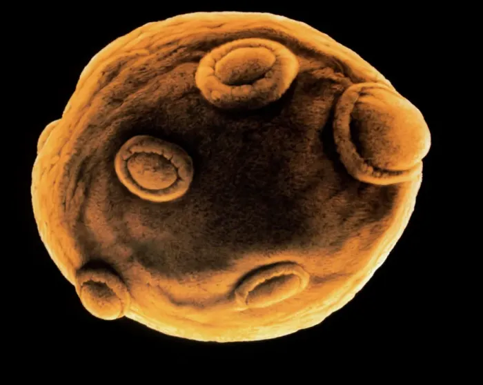 Framed Print : Yeast Cell Budding Print Framed Print : Yeast Cell Budding Print