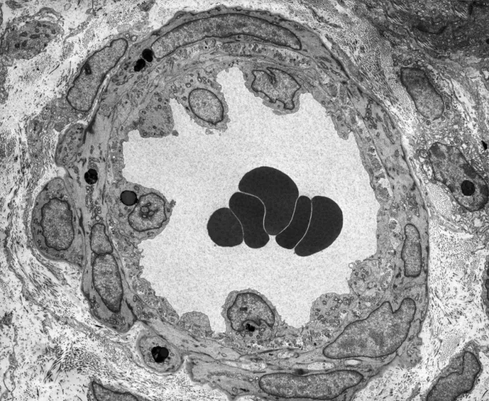 Framed Print : TEM Print of Constricted Arteriole Framed Print : TEM Print of Constricted Arteriole