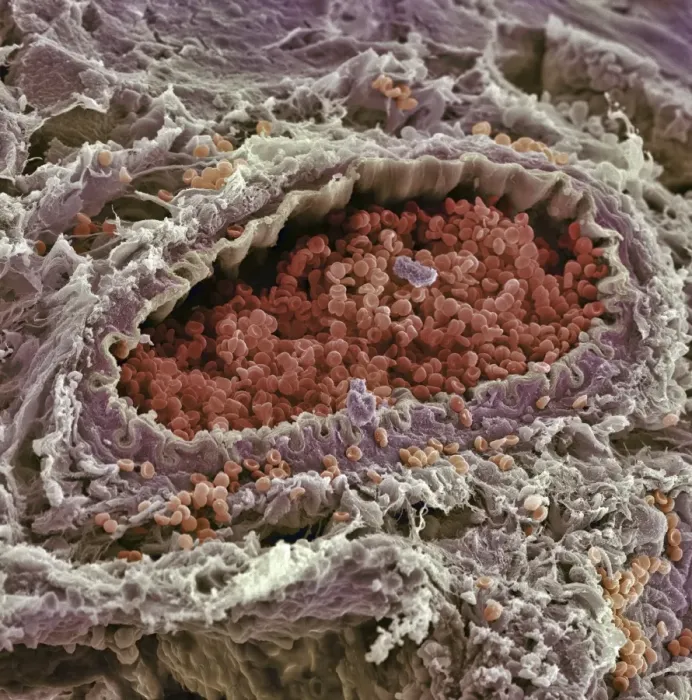 Framed Print : Coloured SEM Print of a Sectioned Artery Framed Print : Coloured SEM Print of a Sectioned Artery