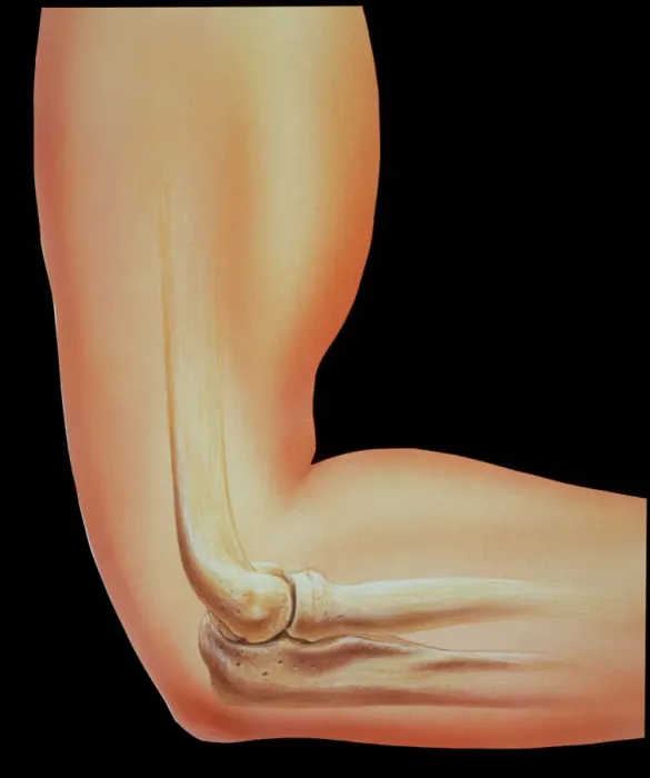 Framed Print : Elbow Joint Bones Print