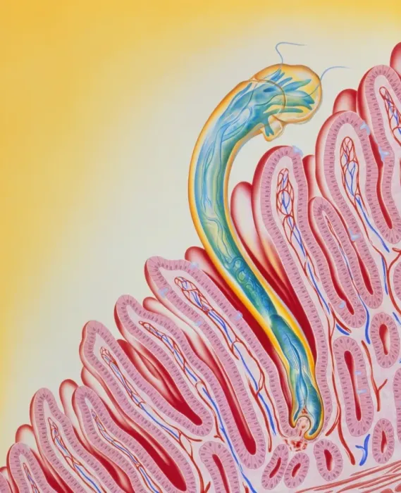 Framed Print : Hookworm clinging to intestinal lining Print Framed Print : Hookworm clinging to intestinal lining Print
