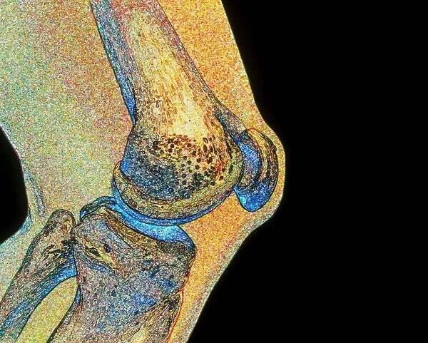 Artwork of human knee joint, side view