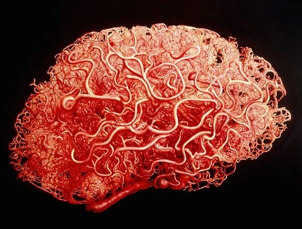 Artwork showing the blood vessels of the brain