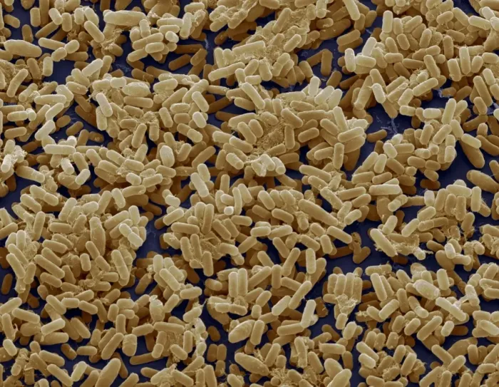 Framed Print : Bacillus subtilis bacteria print Framed Print : Bacillus subtilis bacteria print