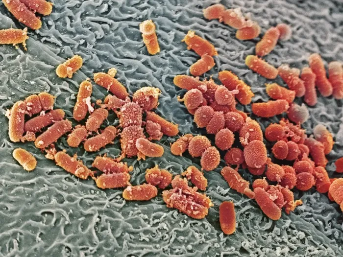 Framed Print : SEM Print of Bacteria in the Nasal Cavity Framed Print : SEM Print of Bacteria in the Nasal Cavity