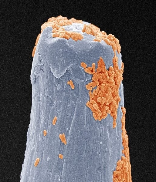 Bacteria on a pin, SEM